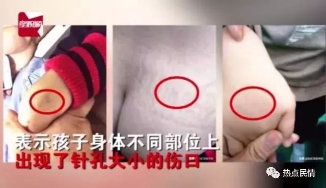 5名幼儿园老师涉嫌虐待被刑拘,幼儿园负责人